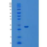 人UBE2M重组蛋白