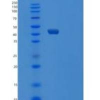 人泛素样修饰激活酶5(UBA5)重组蛋白