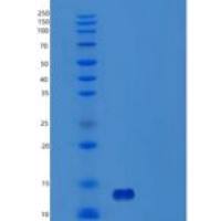 人硫代硫酸盐硫酸转移酶/含罗丹明类结构域的蛋白3(tstd 3)重组蛋白