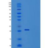 人TPRKB重组蛋白