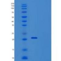 人TPRKB重组蛋白