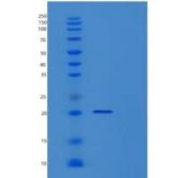 人TPPP3重组蛋白