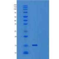 人尿溶蛋白2(UPK2)重组蛋白