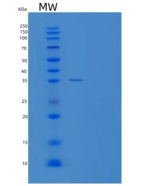 人硫氧还蛋白样蛋白1(TXNL1)重组蛋白