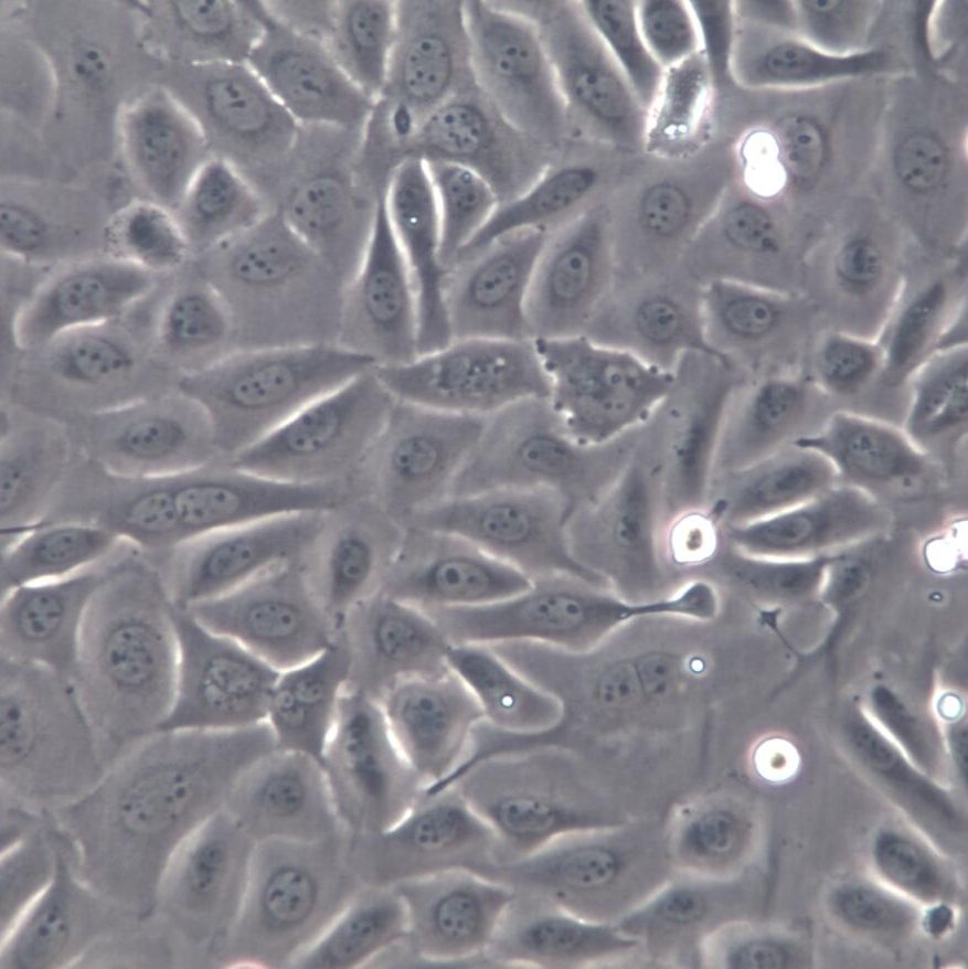 HCC1143、HCC1143细胞系、HCC1143细胞株、HCC1143人乳腺癌细胞