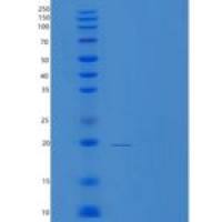 人TXNL4A重组蛋白