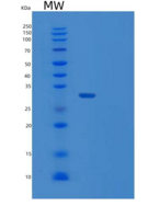 人肥胖相关蛋白1（tul P1）重组蛋白