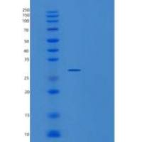 人丙糖磷酸异构酶1(TPI1)重组蛋白