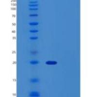 人TTC32重组蛋白