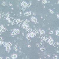 NCI-H209 人小细胞肺癌细胞/STR鉴定/镜像绮点(Cellverse)