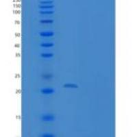 人TXNL4B重组蛋白