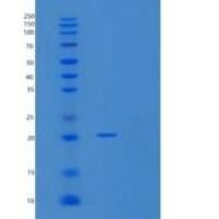 人UBE2G1重组蛋白