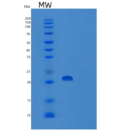 人运输蛋白粒子复合体3(TRAPPC3)重组蛋白