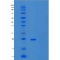 人泛素结合酶E2C结合蛋白E2D2(UBE2D2)重组蛋白