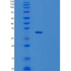 人肥胖相关蛋白1（tul P1）重组蛋白