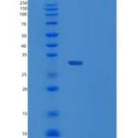 人肥胖相关蛋白1（tul P1）重组蛋白