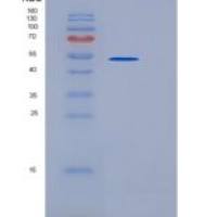 人泛素样修饰激活酶3(UBA3)重组蛋白