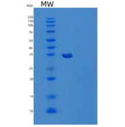 人TRIP10重组蛋白