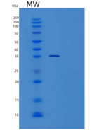 人TSNAX重组蛋白