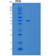 人UBLCP1重组蛋白