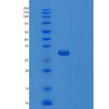 人TRPT1重组蛋白