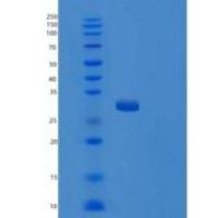 人TRPT1重组蛋白