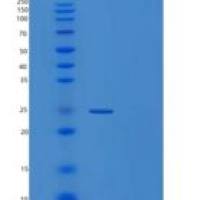 人Trypsin-3重组蛋白