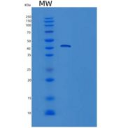 人TRIB3重组蛋白