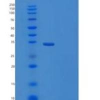 大肠杆菌TRXB重组蛋白