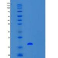 人UFSP1重组蛋白