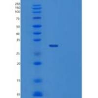 人τ-蛋白激酶1(tPK1)重组蛋白