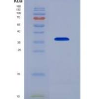 人耐扭蛋白1A(TOR1A)重组蛋白