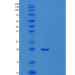 人髓细胞触发受体2(TREM2)重组蛋白