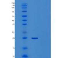 人髓细胞触发受体2(TREM2)重组蛋白