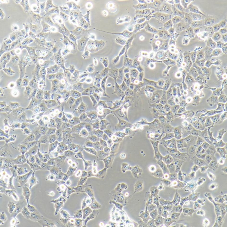NCI-H1299 人非小细胞肺癌细胞 STR鉴定  参考文献 镜像绮点（Cellverse）