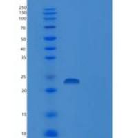 人骨骼肌慢肌肌钙蛋白I(TNNI1)重组蛋白