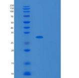 大肠杆菌UDP重组蛋白