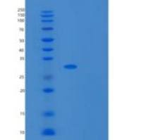 大肠杆菌UDP重组蛋白