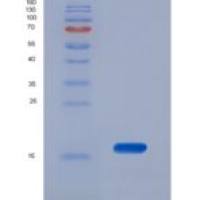 人运输蛋白粒子复合体2(TRAPPC2)重组蛋白