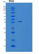人尿嘧啶核苷磷酸化酶1(UPP1)重组蛋白