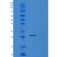 小鼠翻译调节肿瘤蛋白1(TPT1)重组蛋白
