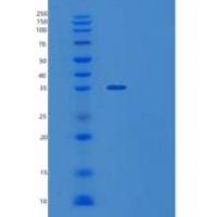 人TPGS2重组蛋白