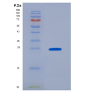 人泛素结合酶E2C(UBE2C)重组蛋白