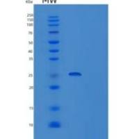 人运输蛋白粒子复合体4(TRAPPC4)重组蛋白
