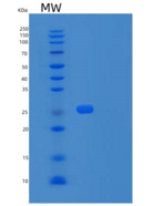 人UBE2E3重组蛋白