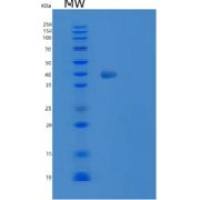 人胸苷酸合成酶(TYMS)重组蛋白