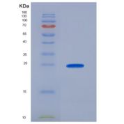 人泛素结合酶E2C(UBE2C)重组蛋白
