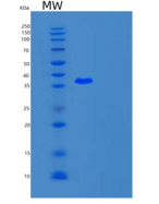 人UFD1L重组蛋白