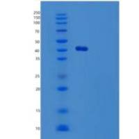 人TSSK2重组蛋白
