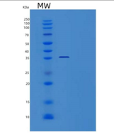 人TSSC4重组蛋白